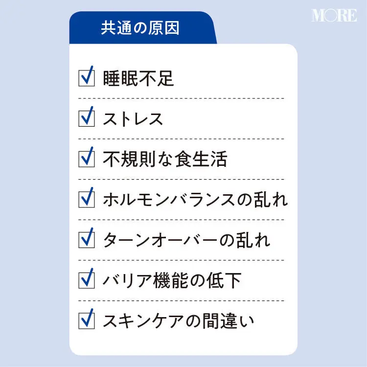 思春期ニキビと大人ニキビの共通した原因一覧　睡眠不足、ストレス、不規則な食生活など