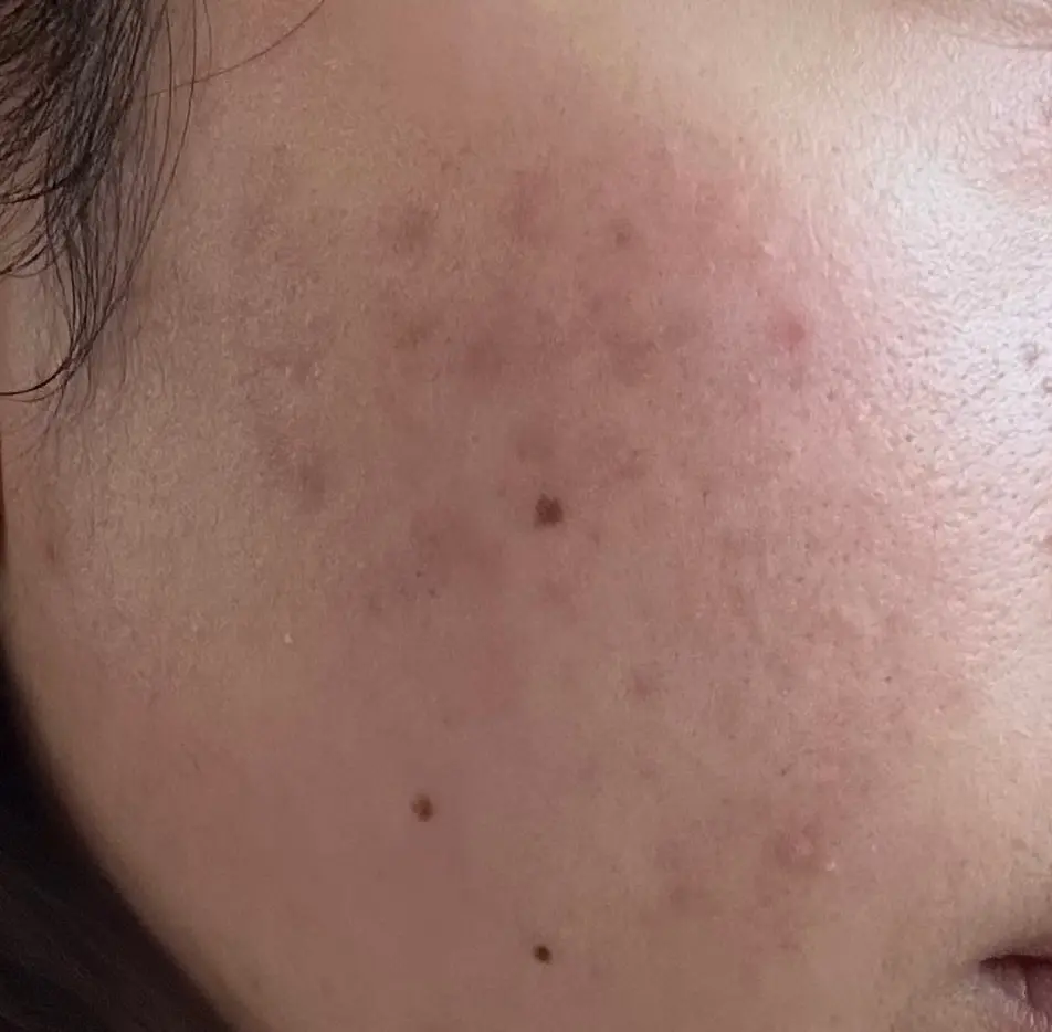 【Qoo10メガ割】“乾燥肌さん”にお勧の画像_5