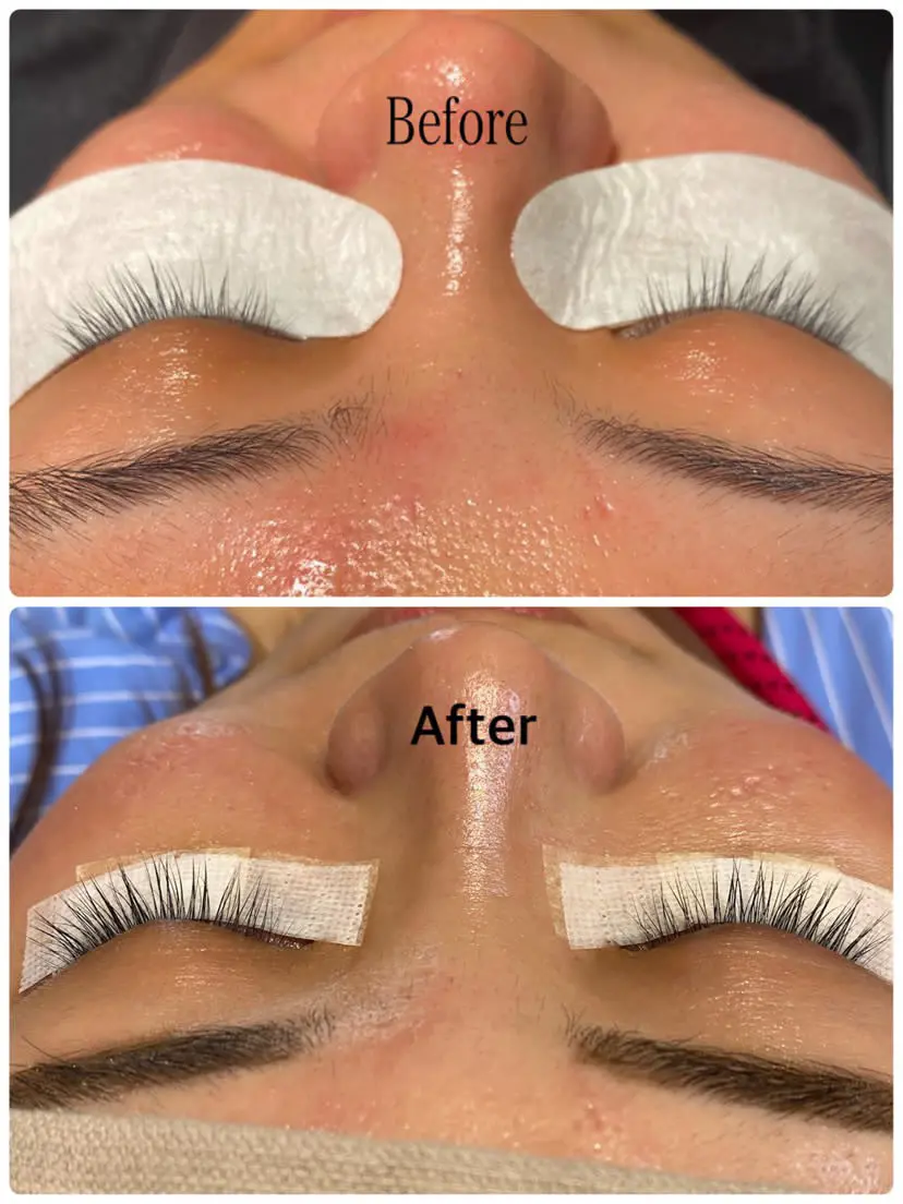 【美容】やっぱり最強だった・・！？1ヶ月の画像_2