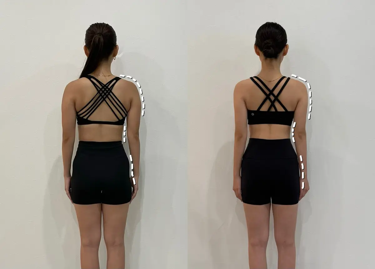 衝撃のビフォーアフター👀10分で「背中」の画像_1